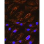 Immunofluorescence - Anti-NDUFA8 Antibody (A80741) - Antibodies.com