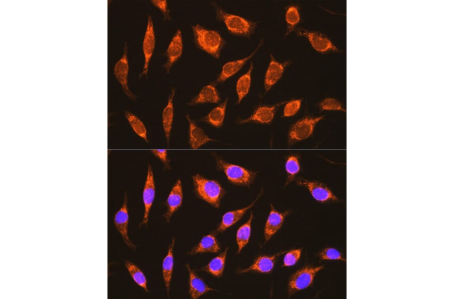 Immunofluorescence - Anti-NDUFA8 Antibody (A80741) - Antibodies.com