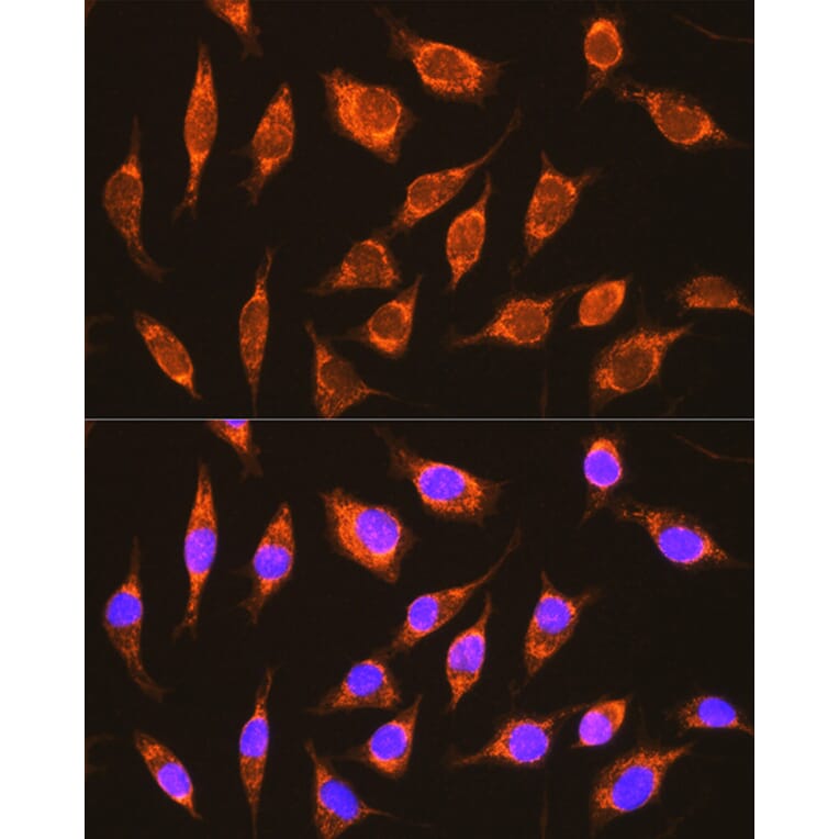 Immunofluorescence - Anti-NDUFA8 Antibody (A80741) - Antibodies.com