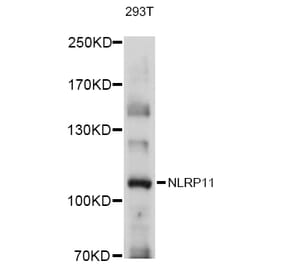 Western Blot - Anti-NLRP11 Antibody (A80742) - Antibodies.com