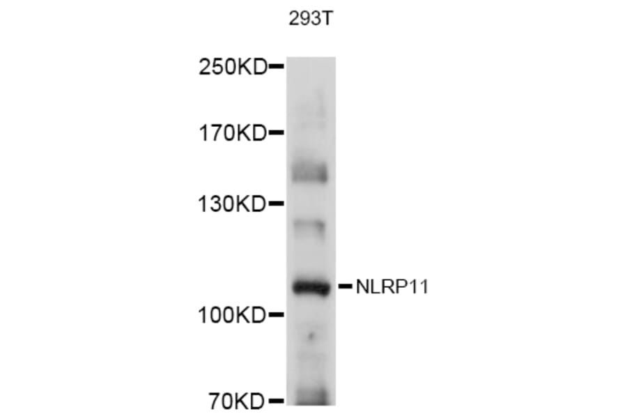 Western Blot - Anti-NLRP11 Antibody (A80742) - Antibodies.com
