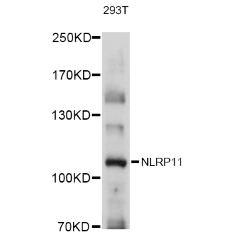 Western Blot - Anti-NLRP11 Antibody (A80742) - Antibodies.com