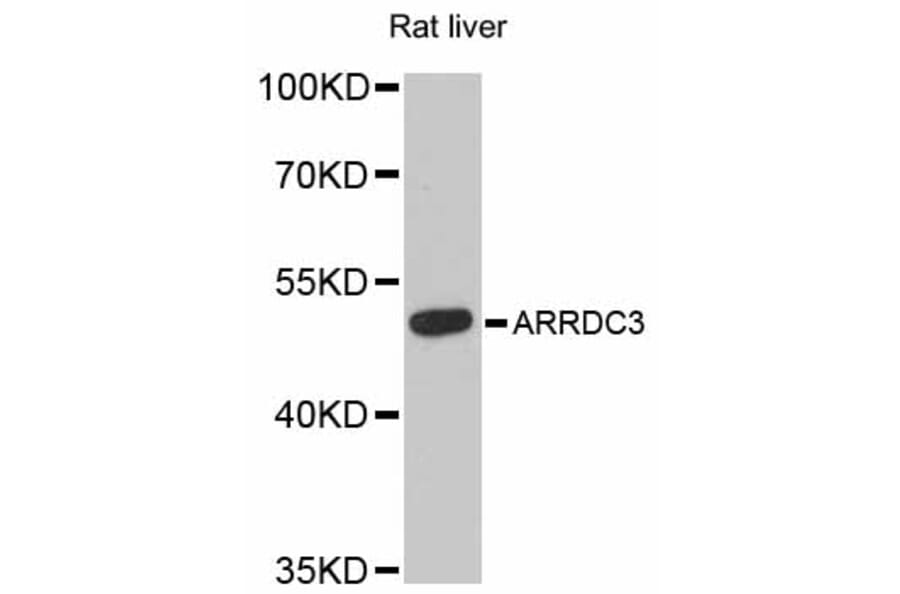 Western Blot - Anti-ARRDC3 Antibody (A12145) - Antibodies.com