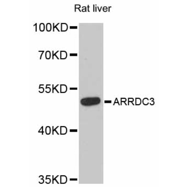Western Blot - Anti-ARRDC3 Antibody (A12145) - Antibodies.com