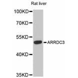 Western Blot - Anti-ARRDC3 Antibody (A12145) - Antibodies.com