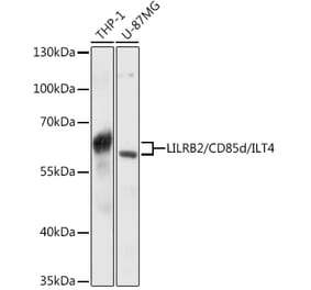 Western Blot - Anti-ILT-4 Antibody (A80744) - Antibodies.com