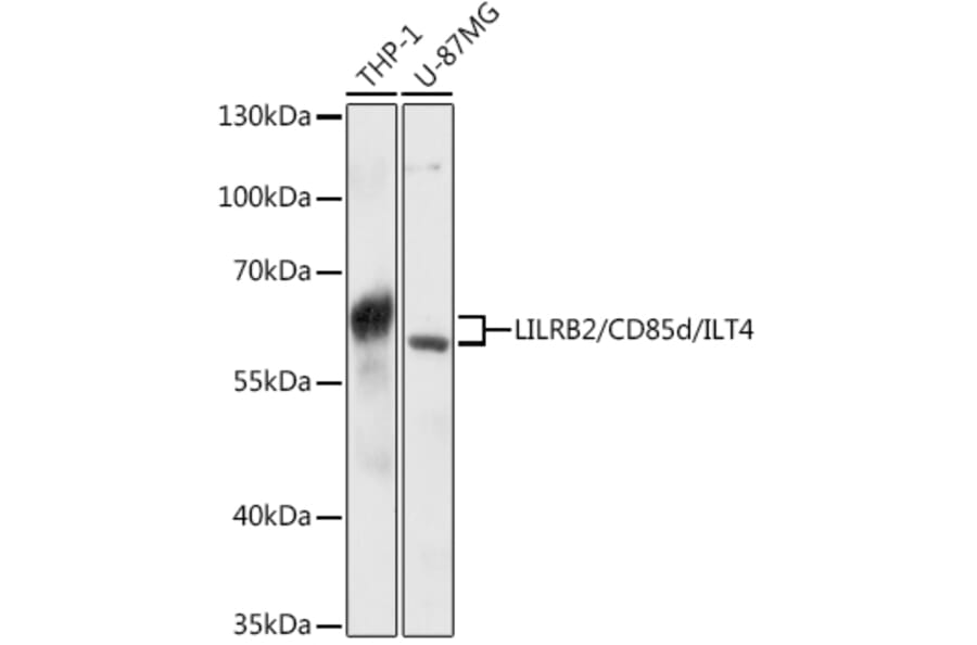 Western Blot - Anti-ILT-4 Antibody (A80744) - Antibodies.com