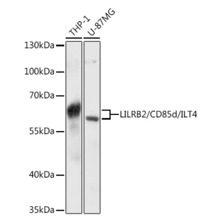 Western Blot - Anti-ILT-4 Antibody (A80744) - Antibodies.com