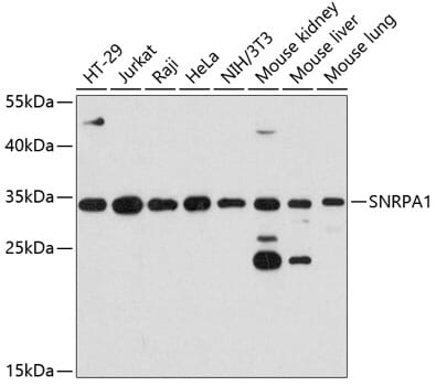 Western blot analysis of extracts of various cell lines, using Anti-SNRPA1 Antibody (A12161) at 1:3000 dilution.
Secondary antibody: Goat Anti-Rabbit IgG (H+L) (HRP) (AS014) at 1:10,000 dilution.
Lysates / proteins: 25µg per lane.
Blocking buffer: 3% non-fat dry milk in TBST.
Detection: ECL Basic Kit (RM00020).
Exposure time: 10s.