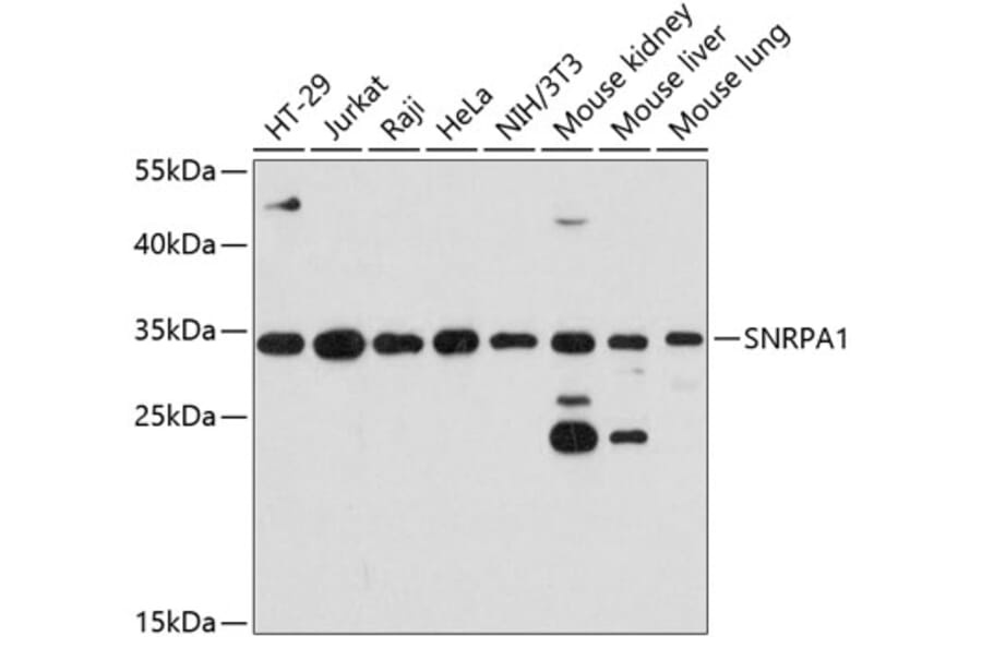 Western Blot - Anti-SNRPA1 Antibody (A80745) - Antibodies.com