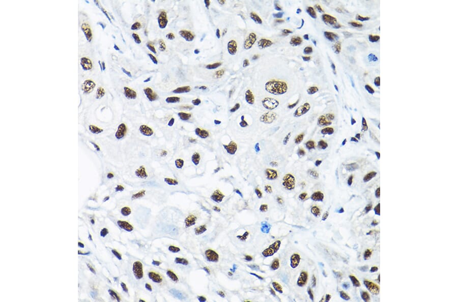 Immunohistochemistry - Anti-SNRPA1 Antibody (A80745) - Antibodies.com