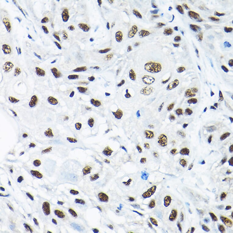 Immunohistochemistry - Anti-SNRPA1 Antibody (A80745) - Antibodies.com