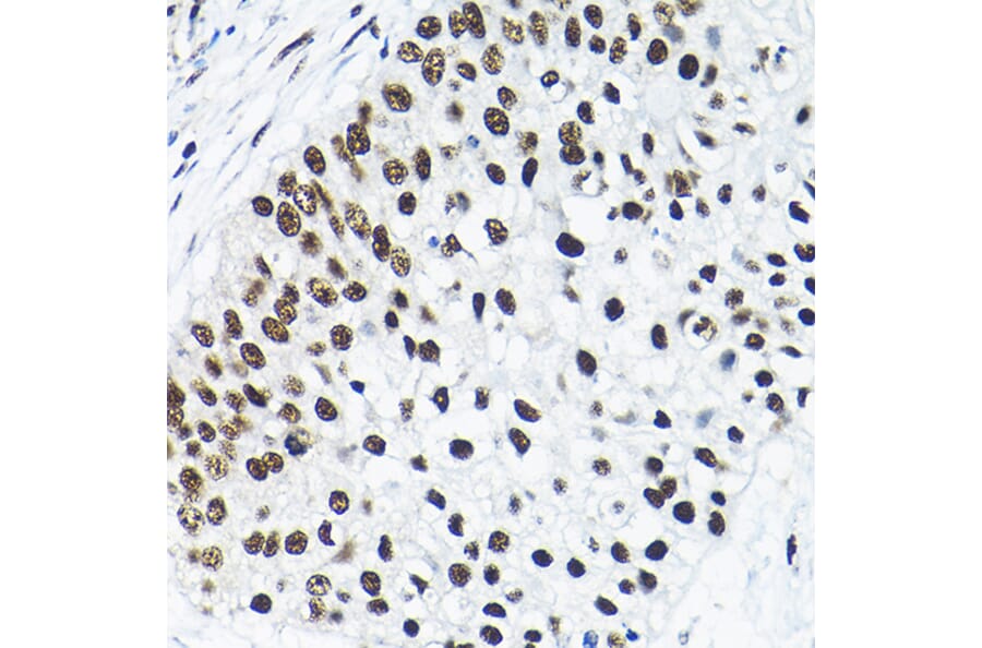 Immunohistochemistry - Anti-SNRPA1 Antibody (A80745) - Antibodies.com