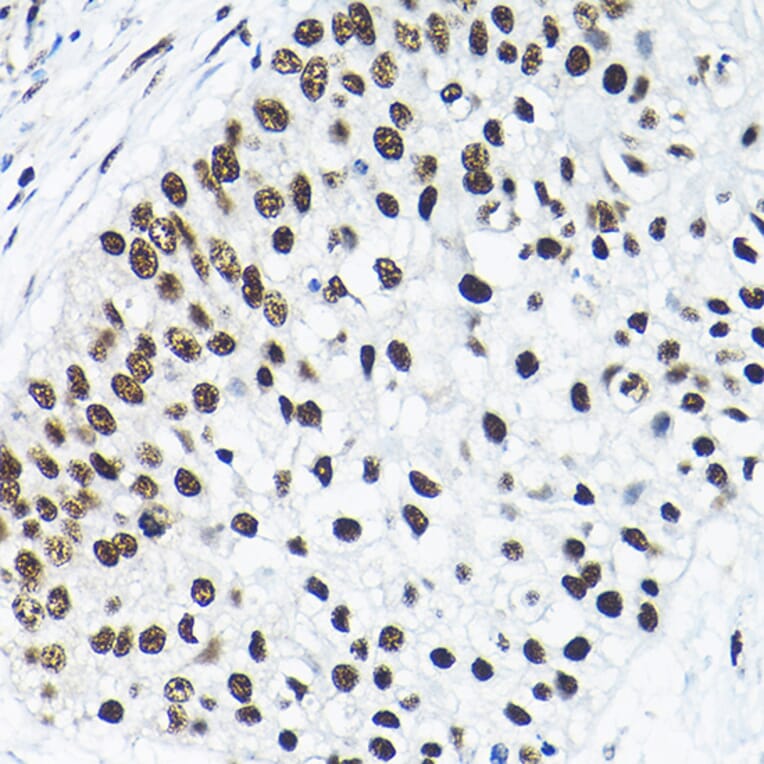 Immunohistochemistry - Anti-SNRPA1 Antibody (A80745) - Antibodies.com