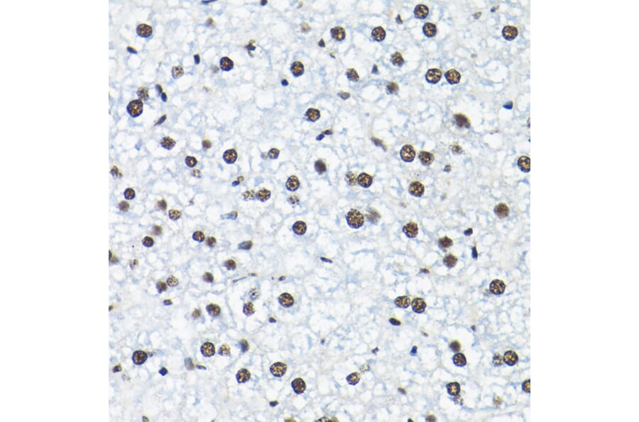 Immunohistochemistry - Anti-SNRPA1 Antibody (A80745) - Antibodies.com