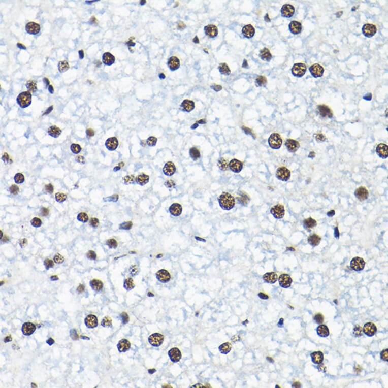 Immunohistochemistry - Anti-SNRPA1 Antibody (A80745) - Antibodies.com