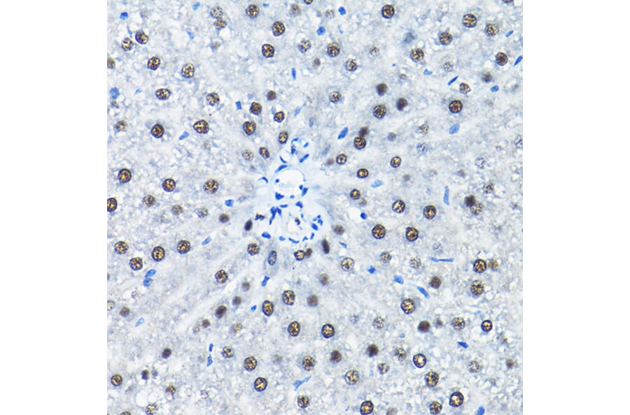 Immunohistochemistry - Anti-SNRPA1 Antibody (A80745) - Antibodies.com