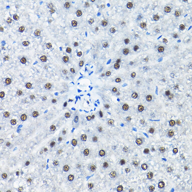 Immunohistochemistry - Anti-SNRPA1 Antibody (A80745) - Antibodies.com
