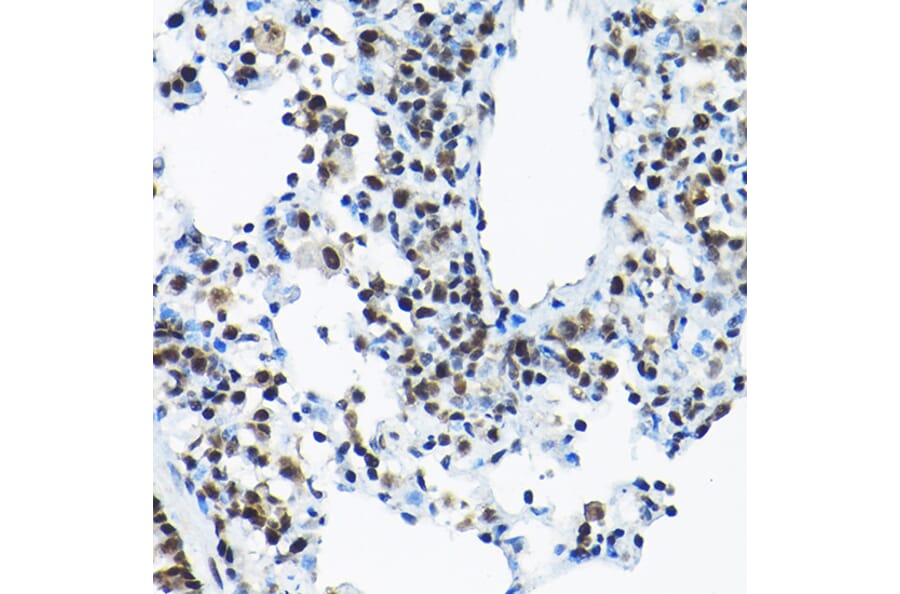 Immunohistochemistry - Anti-SNRPA1 Antibody (A80745) - Antibodies.com