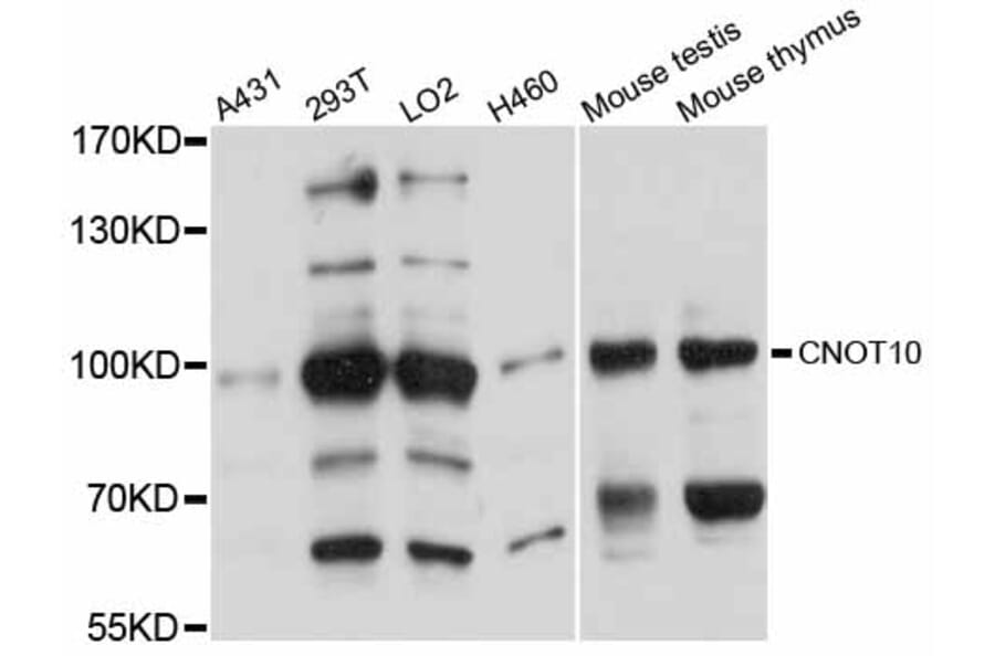 Western Blot - Anti-CNOT10 Antibody (A12164) - Antibodies.com