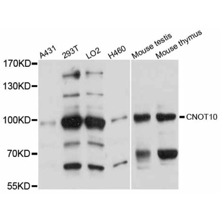 Western Blot - Anti-CNOT10 Antibody (A12164) - Antibodies.com