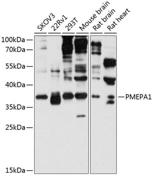 Western blot analysis of extracts of various cell lines, using Anti-PMEPA1 Antibody (A12171) at 1:3000 dilution.
Secondary antibody: Goat Anti-Rabbit IgG (H+L) (HRP) (AS014) at 1:10,000 dilution.
Lysates / proteins: 25µg per lane.
Blocking buffer: 3% non-fat dry milk in TBST.
Detection: ECL Basic Kit (RM00020).
Exposure time: 30s.