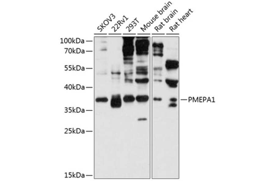Western Blot - Anti-TMEPAI Antibody (A80747) - Antibodies.com