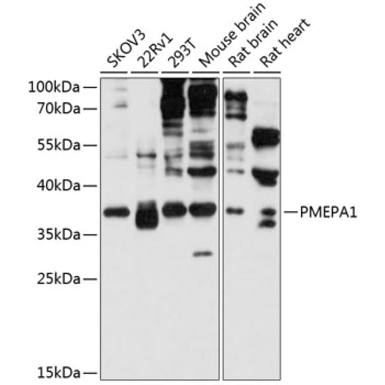 Western Blot - Anti-TMEPAI Antibody (A80747) - Antibodies.com
