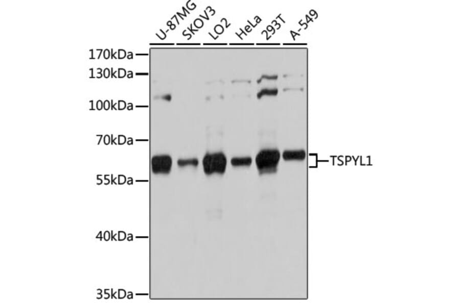 Western Blot - Anti-TSPYL1 Antibody (A12174) - Antibodies.com