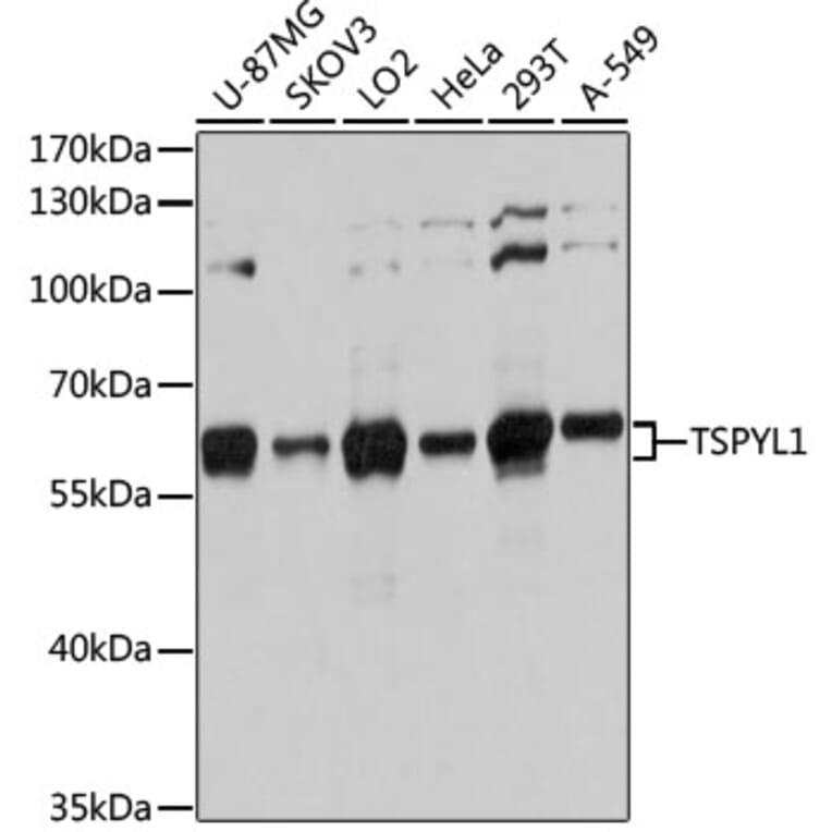 Western Blot - Anti-TSPYL1 Antibody (A12174) - Antibodies.com