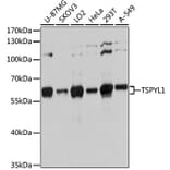 Western Blot - Anti-TSPYL1 Antibody (A12174) - Antibodies.com