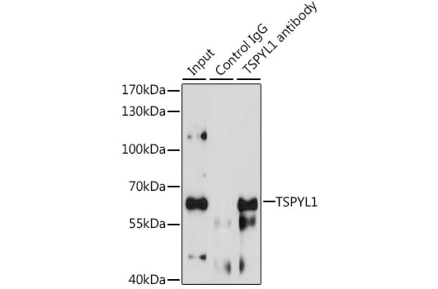 Immunoprecipitation - Anti-TSPYL1 Antibody (A12174) - Antibodies.com