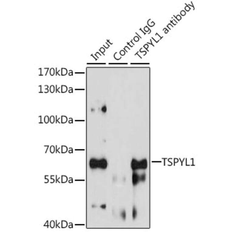 Immunoprecipitation - Anti-TSPYL1 Antibody (A12174) - Antibodies.com