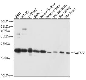 Western Blot - Anti-ATRAP Antibody (A80749) - Antibodies.com