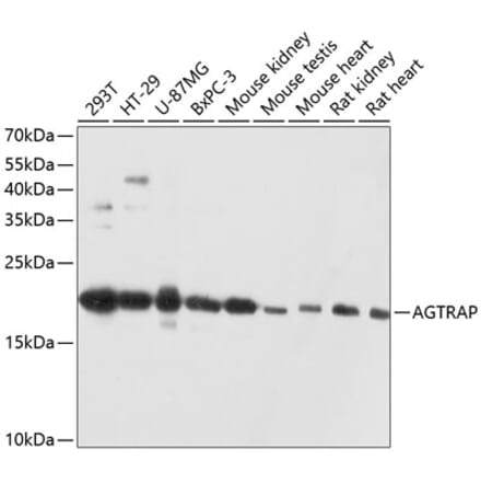 Western Blot - Anti-ATRAP Antibody (A80749) - Antibodies.com