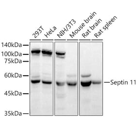 Western Blot - Anti-Septin 11 Antibody (A80750) - Antibodies.com