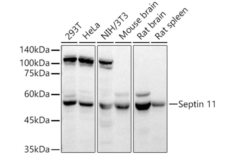 Western Blot - Anti-Septin 11 Antibody (A80750) - Antibodies.com