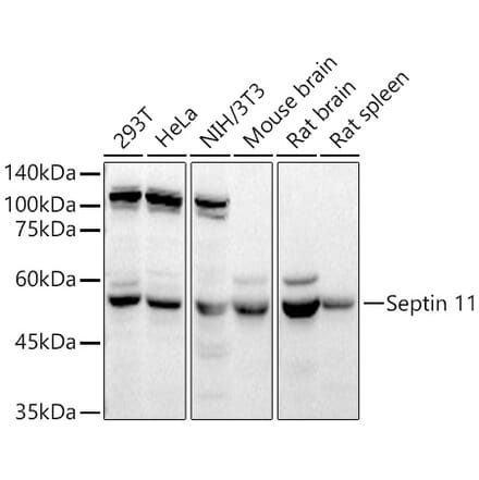 Western Blot - Anti-Septin 11 Antibody (A80750) - Antibodies.com