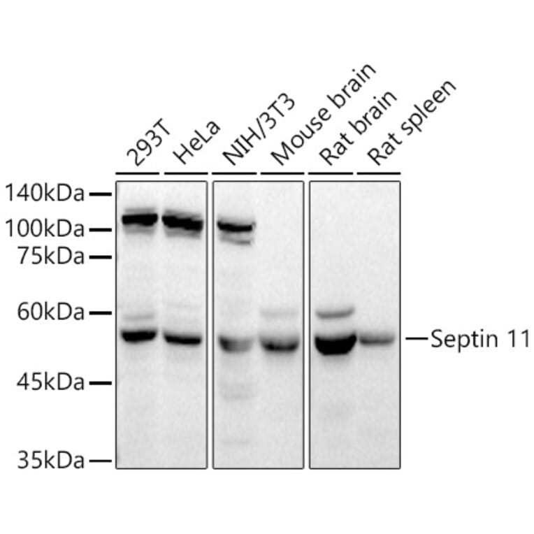 Western Blot - Anti-Septin 11 Antibody (A80750) - Antibodies.com