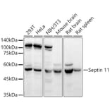 Western Blot - Anti-Septin 11 Antibody (A80750) - Antibodies.com