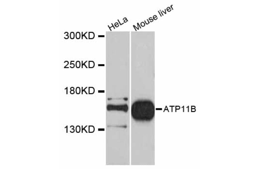 Western Blot - Anti-ATP11B Antibody (A12203) - Antibodies.com