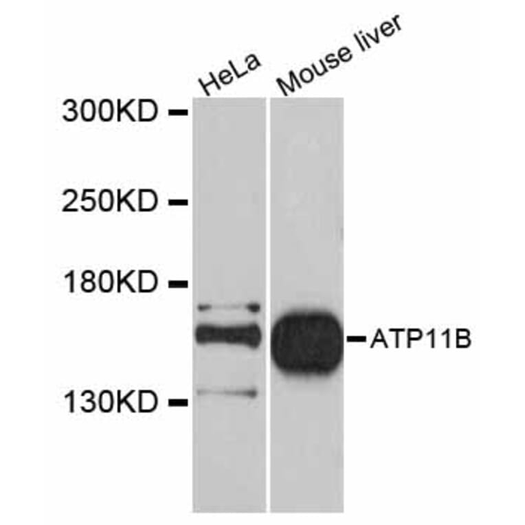Western Blot - Anti-ATP11B Antibody (A12203) - Antibodies.com