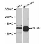Western Blot - Anti-ATP11B Antibody (A12203) - Antibodies.com