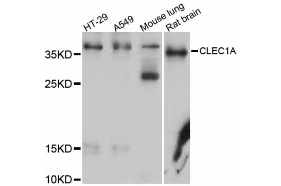 Western Blot - Anti-CLEC1A Antibody (A12207) - Antibodies.com
