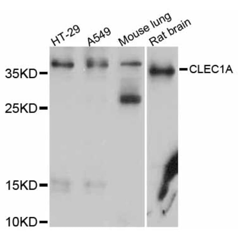 Western Blot - Anti-CLEC1A Antibody (A12207) - Antibodies.com