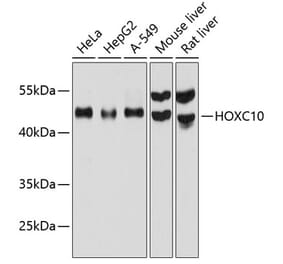 Western Blot - Anti-HOXC10 Antibody (A80753) - Antibodies.com