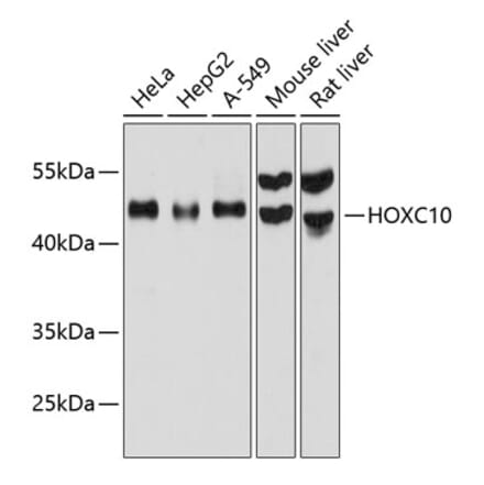 Western Blot - Anti-HOXC10 Antibody (A80753) - Antibodies.com