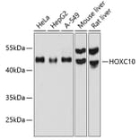 Western Blot - Anti-HOXC10 Antibody (A80753) - Antibodies.com