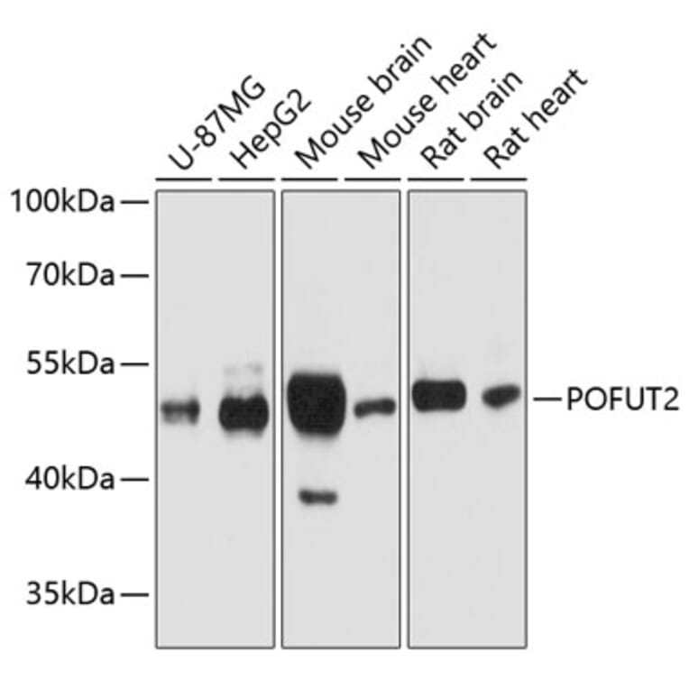 Western Blot - Anti-POFUT2 Antibody (A80754) - Antibodies.com