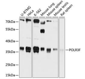 Western Blot - Anti-RPC39 Antibody (A80755) - Antibodies.com